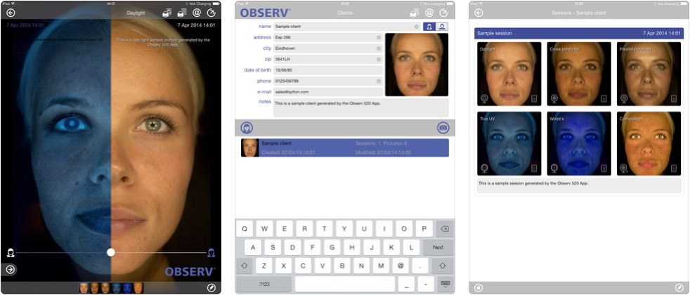 Overview of the OBSERV 520 iOS App